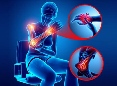 Đau mỏi cổ vai gáy kèm theo tê tay