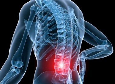 Thoái hóa cột sống thắt lưng, căn bệnh âm thầm nhưng nguy hiểm